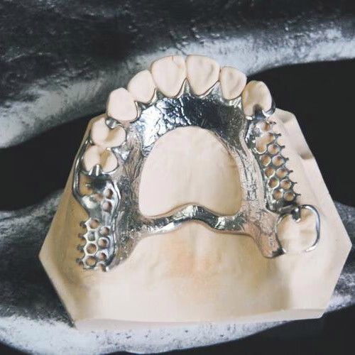 3D打印假牙(3d打印 假牙)